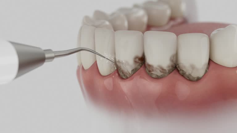 Trusted Tooth Extraction service in New Martinsville, WV - Dentist Open Now